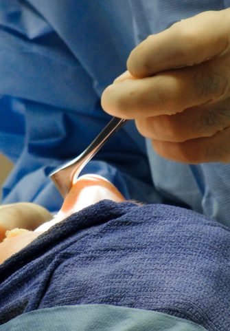 3 Questions To Ask Before Having Cosmetic Surgery