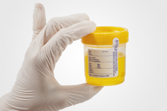 Top Natural Remedies to Pass a Drug Test in a Week